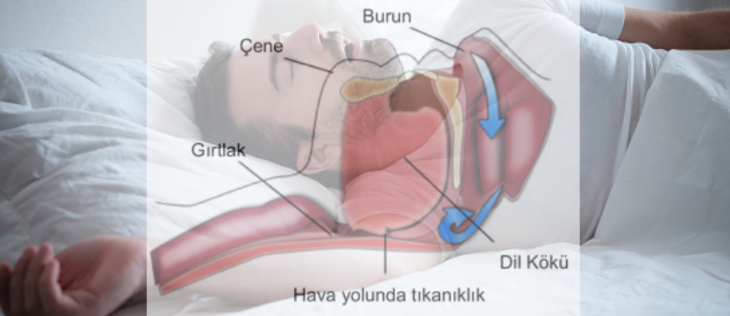 osas biyoistatistik analiz